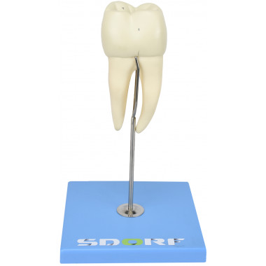 Dente Molar Inferior c/ Raiz Dupla em 3 Partes c/ Cárie, 8x o Tamanho Real Aprox.