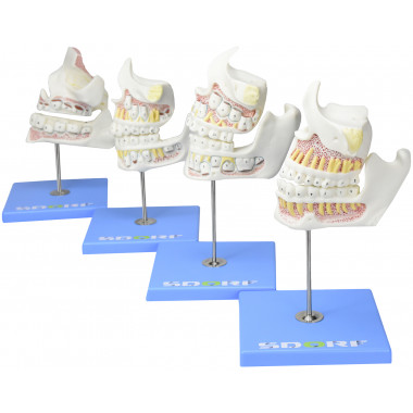 Desenvolvimento da Dentição em 4 Etapas