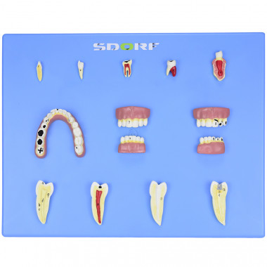  Modelo de Patologias Dentárias c/ 12 Partes em Placa