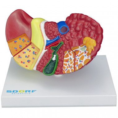 Modelo Patológico do Fígado e Vesícula Biliar