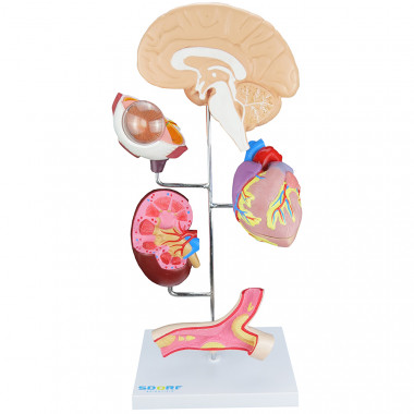 Modelo de Órgãos afetados pela Hipertensão em 8 partes