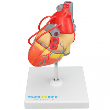 Modelo Patológico do Coração com Pontagem Coronária