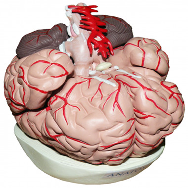 Cérebro com Artérias com 9 Partes