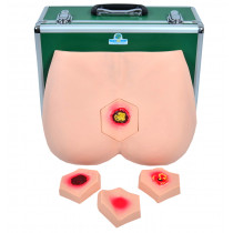 Simulador para Cuidados da Úlcera no Decúbito e Avaliação da Evolução Simulador para Cuidados da Úlcera no Decúbito e Avaliação da Evolução