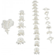 Coluna Desarticulada Coluna Desarticulada