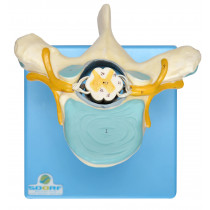 Vértebra Torácica C/ Cordão Espinhal Vértebra Torácica C/ Cordão Espinhal