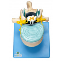 Vértebra Lombar C/ Cordão Espinhal, Nervo e Cauda Equina Vértebra Lombar C/ Cordão Espinhal, Nervo e Cauda Equina
