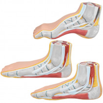 Modelo anatômico dos Pés (Normal – Chato – Curvo) SD-5021/C Modelo anatômico dos Pés (Normal – Chato – Curvo) SD-5021/C