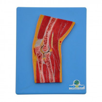 Secção Mediana do Cotovelo Secção Mediana do Cotovelo