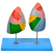 Pulmão Segmentado em Cores Pulmão Segmentado em Cores