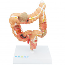 Modelo Patológico do Cólon e Reto Modelo Patológico do Cólon e Reto