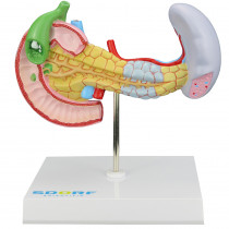 Modelo Patológico do Pâncreas, Baço, Duodeno e Vesícula Biliar Modelo Patológico do Pâncreas, Baço, Duodeno e Vesícula Biliar