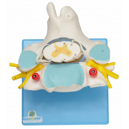 Vértebra Cervical C/ Cordão Espinhal