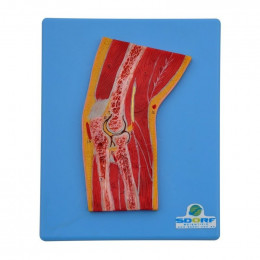 Secção Mediana do Cotovelo