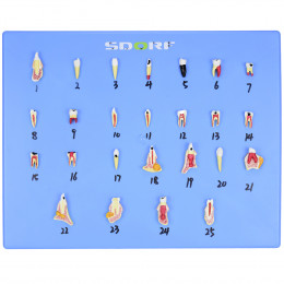 Modelo de Patologias Dentárias c/ 25 Partes em Placa