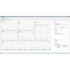 Eletrocardiógrafo Veterinário ECG USB DL650 Vet 7 derivações