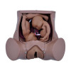 Simulador de Parto Gemelar com Placenta e Cordão Umbilical