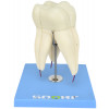 Dente Molar Superior c/ Raiz Tripla em 3 Partes, 8x o Tamanho Real Aprox.