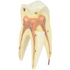 Dente Molar Superior c/ Raiz Tripla em 3 Partes, 8x o Tamanho Real Aprox.