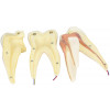 Dente Molar Superior c/ Raiz Tripla em 3 Partes, 8x o Tamanho Real Aprox.