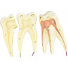 Dente Molar Superior c/ Raiz Tripla em 3 Partes, 8x o Tamanho Real Aprox.