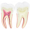 Dentes em 6 Partes (Incisivo, Canino e Molar)
