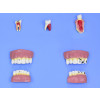  Modelo de Patologias Dentárias c/ 12 Partes em Placa