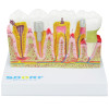 Modelo de Patologias Dentárias