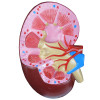 Modelo de Órgãos afetados pela Hipertensão em 8 partes