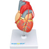 Modelo Patológico do Coração com Pontagem Coronária