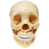 Crânio Mandíbula Aberta com Vasos e Nervos da Arcada Dentária