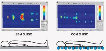 uso do Colchão Pneumático
